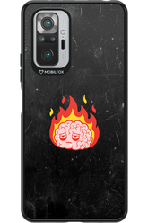 My brain - Xiaomi Redmi Note 10S