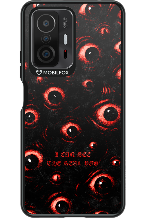 The Watchers - Xiaomi Mi 11T