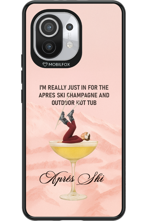 Champagne Tub - Xiaomi Mi 11 5G