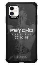 X-Ray - Apple iPhone 11