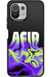 ACIID - Xiaomi Mi 11 Lite (2021)