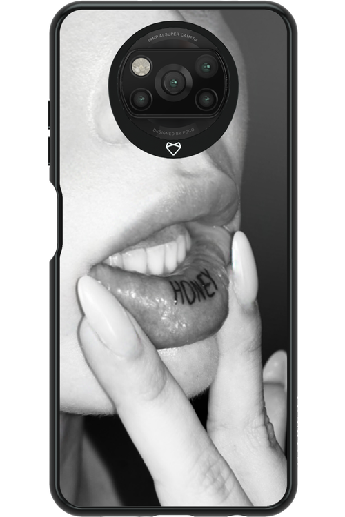 Lip Secret - Xiaomi Poco X3 NFC