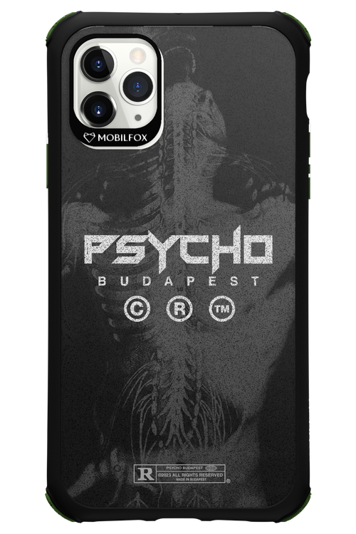 X-Ray - Apple iPhone 11 Pro Max