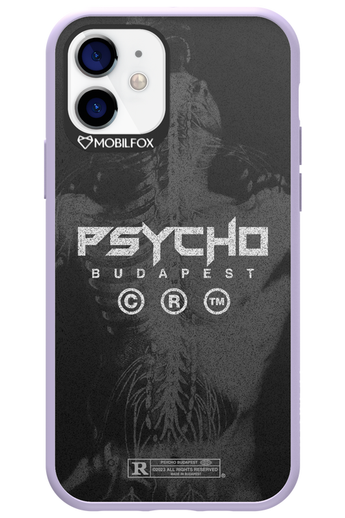 X-Ray - Apple iPhone 12