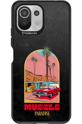 Muscle Paradise - Xiaomi Mi 11 Lite (2021)