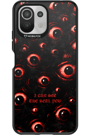 The Watchers - Xiaomi Mi 11 Lite (2021)