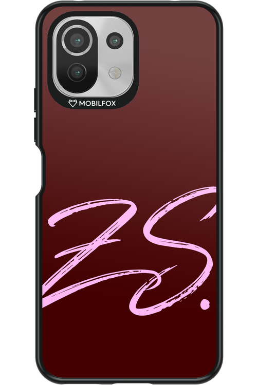 (Dark Blush) ZS 2.0 - Xiaomi Mi 11 Lite (2021)