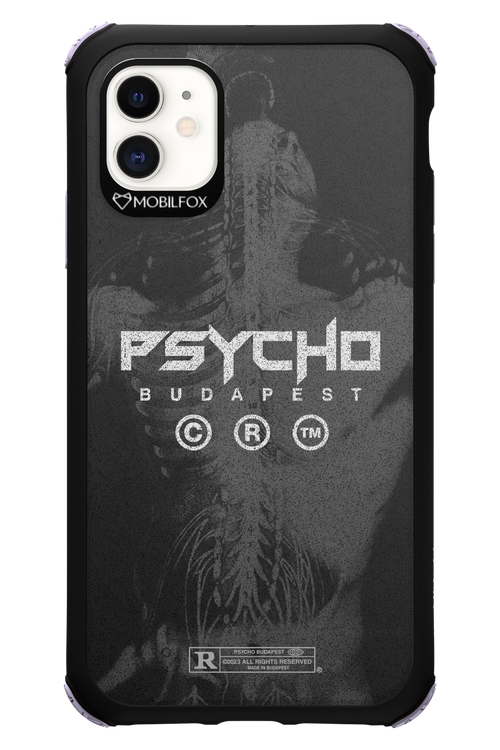 X-Ray - Apple iPhone 11