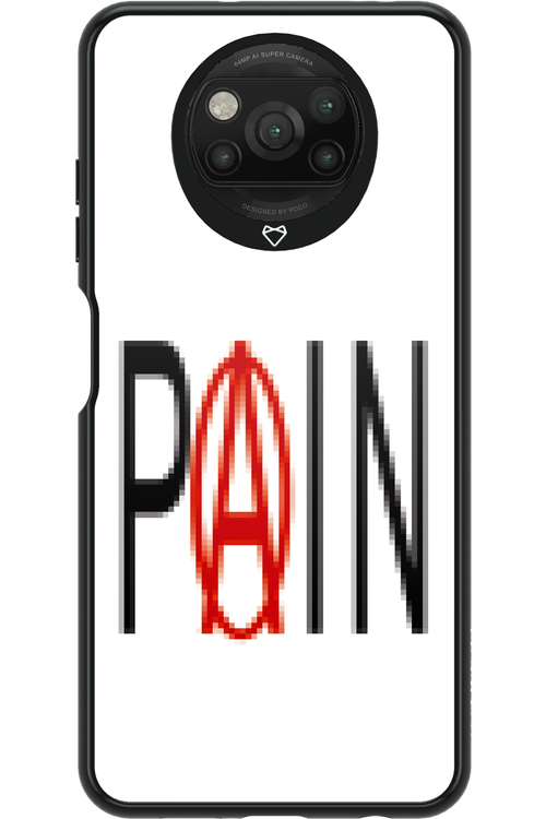 PAIN 2.0 - Xiaomi Poco X3 NFC
