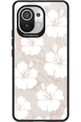 Latte Tropical - Xiaomi Mi 11 5G
