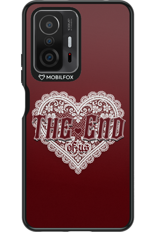 The End (of us) 2.0 - Xiaomi Mi 11T