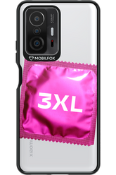 3XL 2.0 - Xiaomi Mi 11T Pro