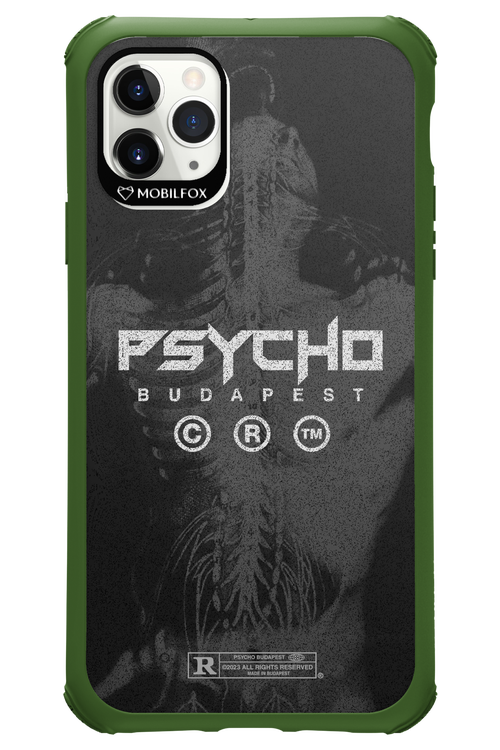 X-Ray - Apple iPhone 11 Pro Max