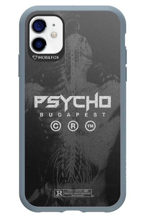X-Ray - Apple iPhone 11