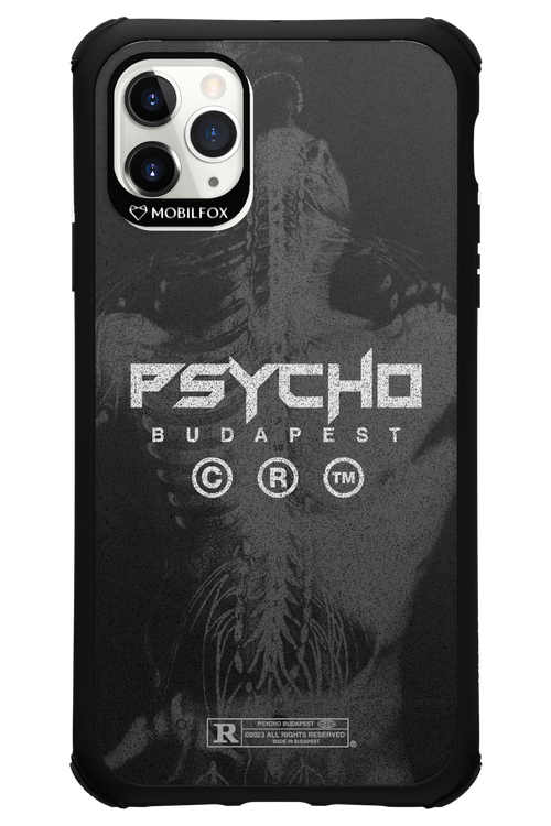 X-Ray - Apple iPhone 11 Pro Max