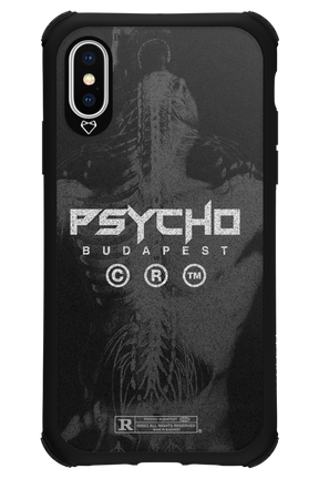 X-Ray - Apple iPhone XS