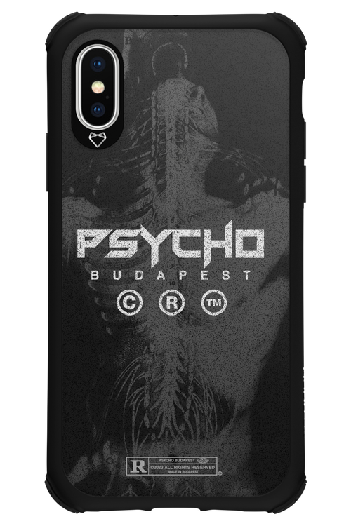 X-Ray - Apple iPhone XS