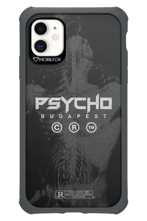 X-Ray - Apple iPhone 11