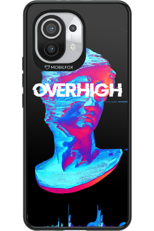 Overhigh - Xiaomi Mi 11 5G