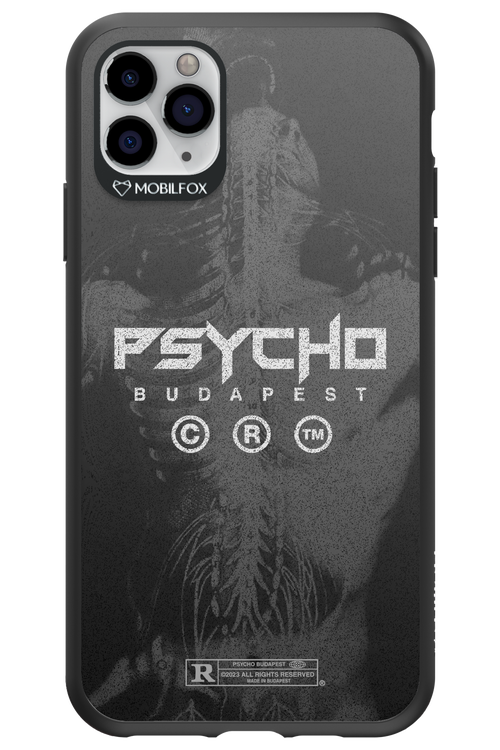 X-Ray - Apple iPhone 11 Pro Max