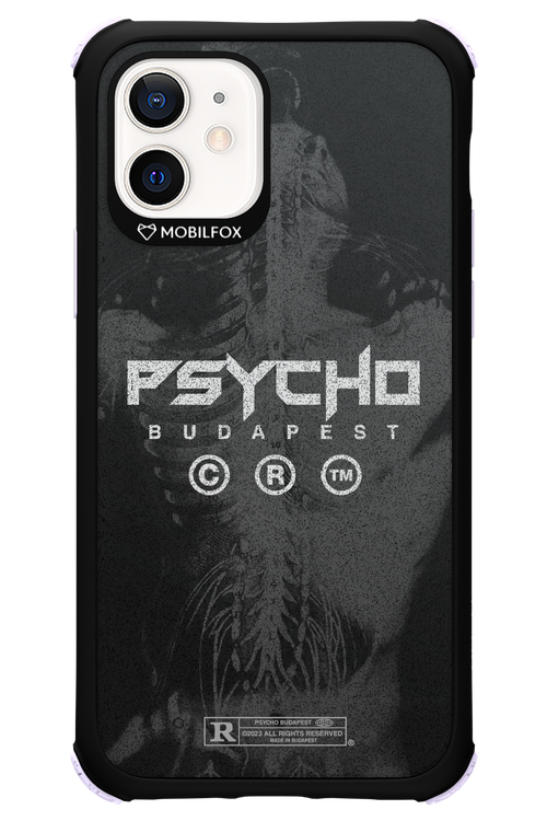 X-Ray - Apple iPhone 12