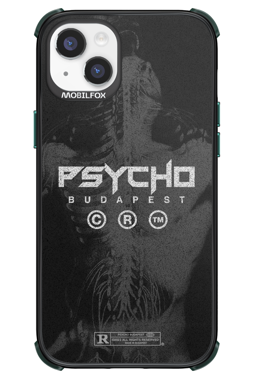 X-Ray - Apple iPhone 14 Plus