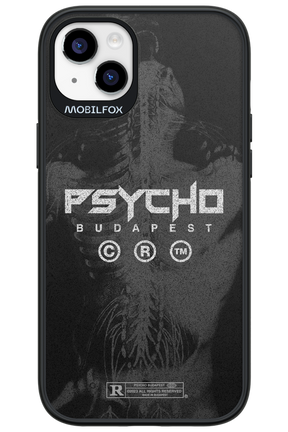 X-Ray - Apple iPhone 14 Plus