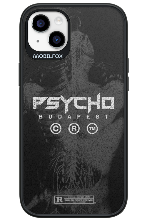 X-Ray - Apple iPhone 14 Plus