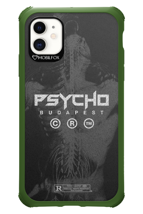 X-Ray - Apple iPhone 11