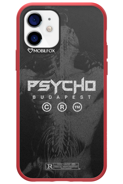 X-Ray - Apple iPhone 12