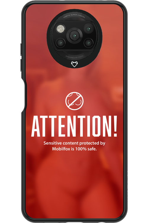 Attention 2.0 - Xiaomi Poco X3 NFC