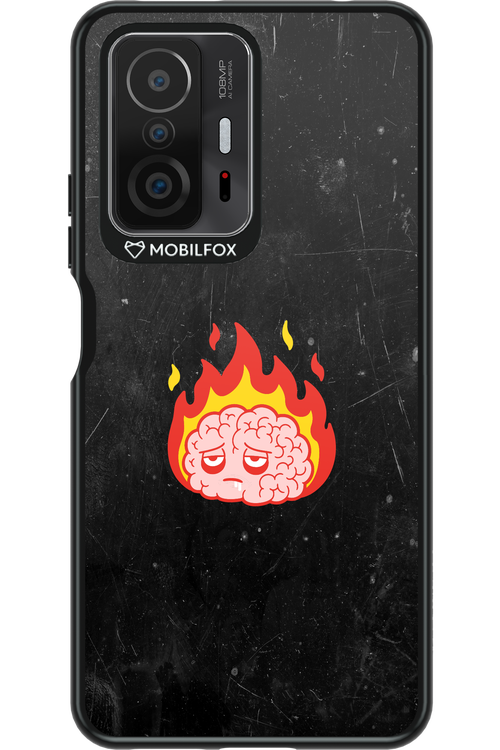 My brain - Xiaomi Mi 11T