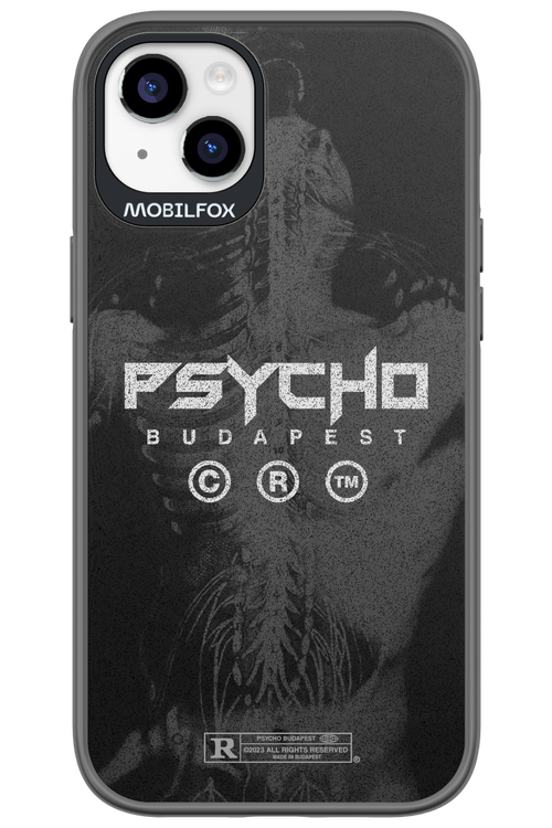 X-Ray - Apple iPhone 14 Plus
