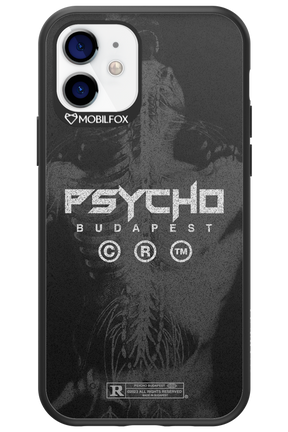 X-Ray - Apple iPhone 12