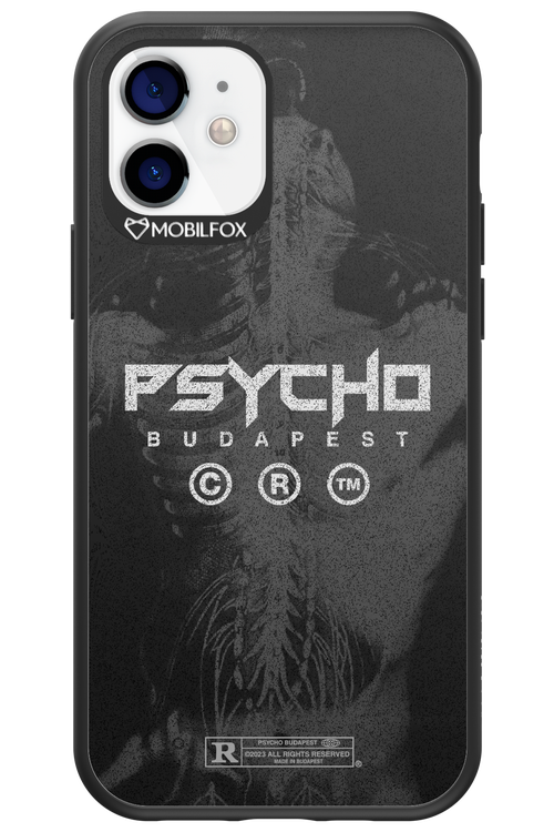 X-Ray - Apple iPhone 12