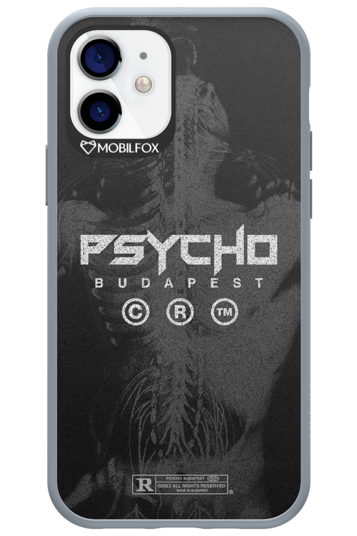X-Ray - Apple iPhone 12