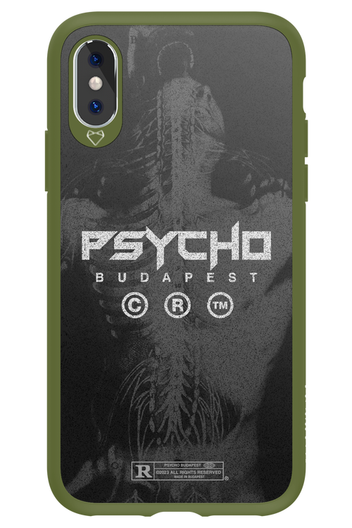 X-Ray - Apple iPhone XS