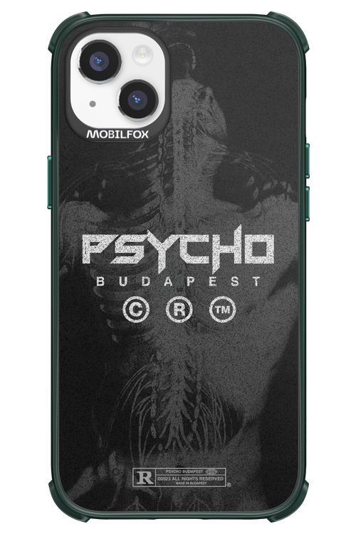 X-Ray - Apple iPhone 14 Plus