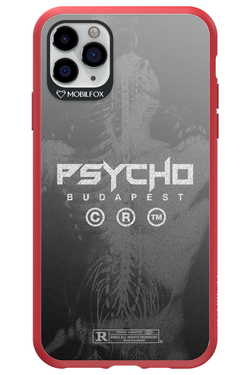 X-Ray - Apple iPhone 11 Pro Max