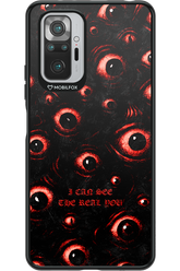 The Watchers - Xiaomi Redmi Note 10 Pro