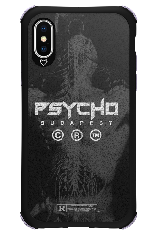X-Ray - Apple iPhone XS
