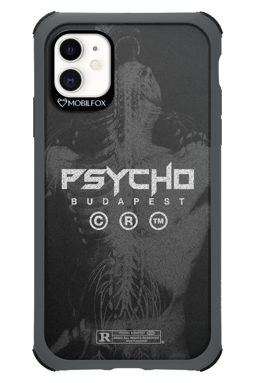 X-Ray - Apple iPhone 11