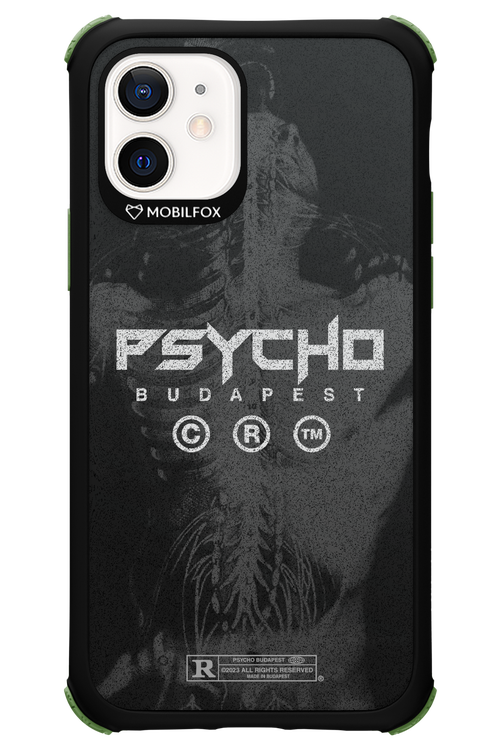 X-Ray - Apple iPhone 12