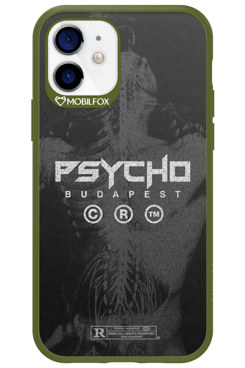 X-Ray - Apple iPhone 12