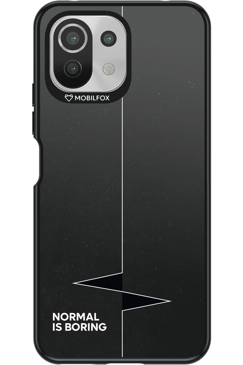 Normal Is Boring 2.0 - Xiaomi Mi 11 Lite (2021)