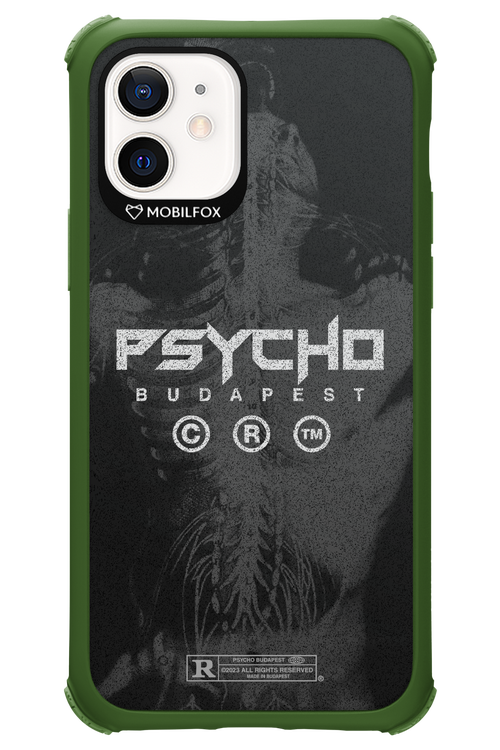 X-Ray - Apple iPhone 12
