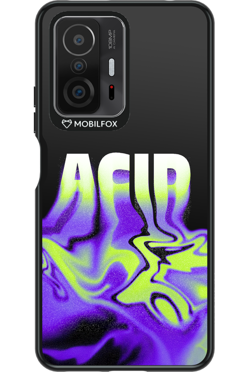 ACIID - Xiaomi Mi 11T