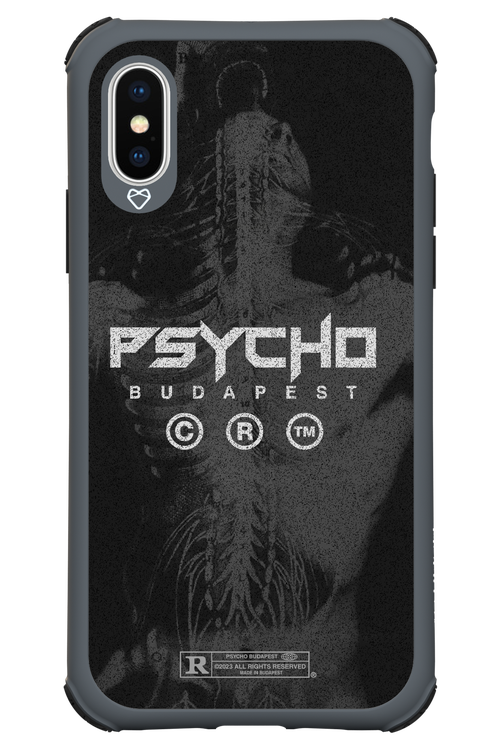 X-Ray - Apple iPhone XS