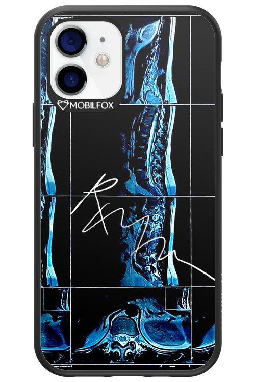 RMN Scolioza 2.0 - Apple iPhone 12