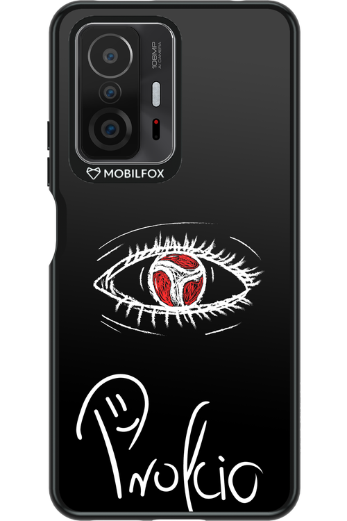 Profcio Eye - Xiaomi Mi 11T